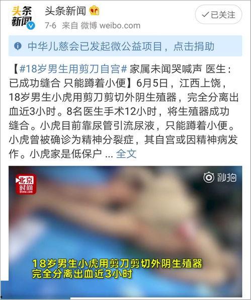 网红烫烟头爆料视频下载,揭秘烟头背后的惊人真相